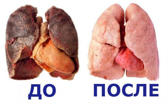 Легені людини до та після куріння